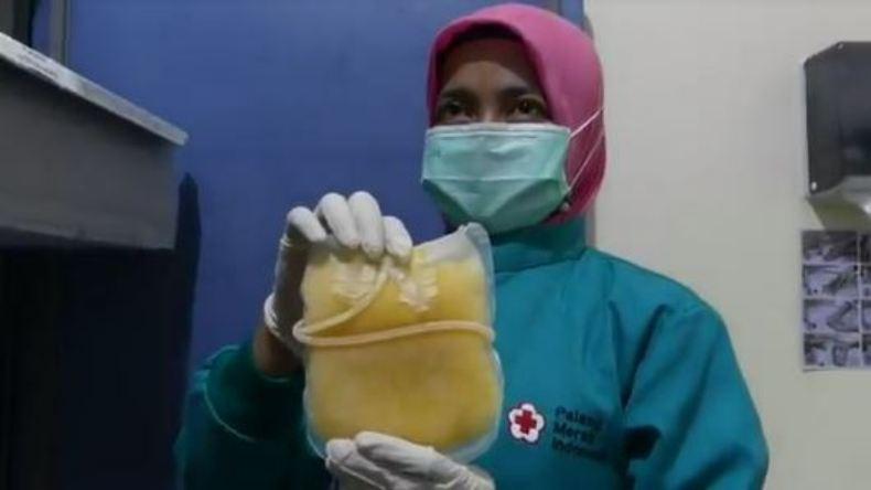 Permintaan Plasma Konvalesen Naik, PMI Solo Dorong Penyintas Covid-19 Jadi Pendonor 
