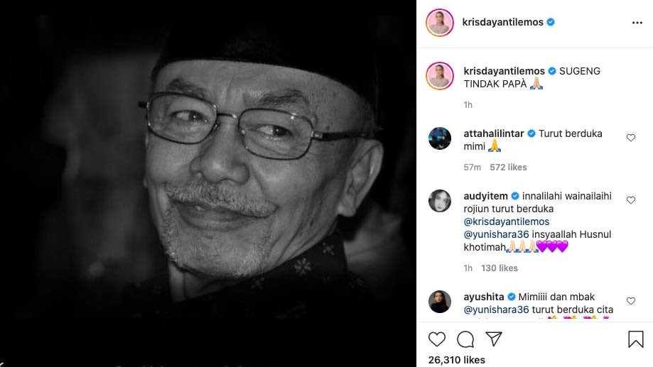 Kabar Duka Ayah Krisdayanti dan Yuni Shara Meninggal Dunia  