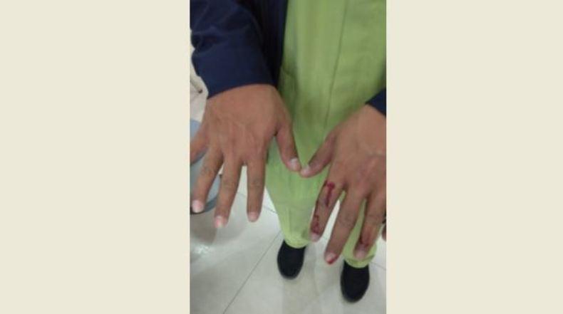 Keluarga Pasien Covid-19 Mengamuk di RSUD Ambarawa, 2 Perawat Terluka 