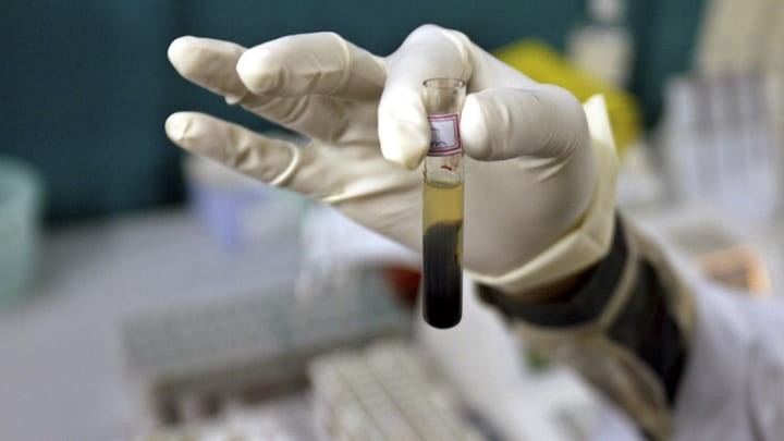 Penularan Hepatitis B dari Ibu ke Anak Capai 95%, Ketahui Bahaya dan Cara Mengendalikannya