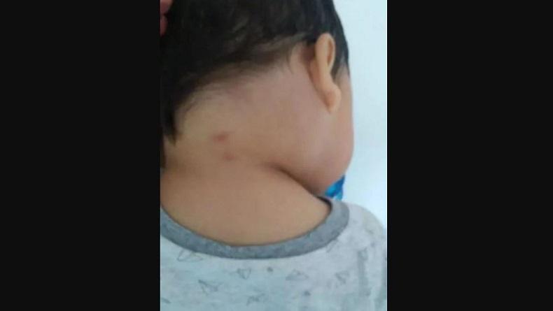 Geger Mahluk Misterius Gigit Balita hingga Tewas, Sang Ibu Curhat di Medsos