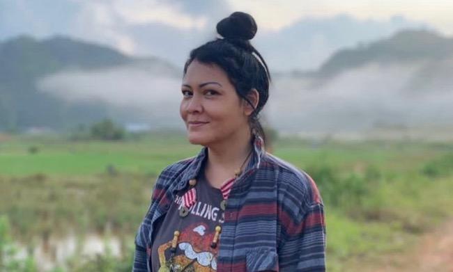 Idap Tumor di Perut, Ternyata Melanie Subono Alami Pendarahan Puluhan Tahun 