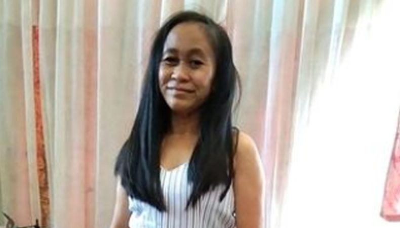  Punya Penyakit Langka, Wajah Remaja 16 Tahun Ini seperti Nenek-Nenek 