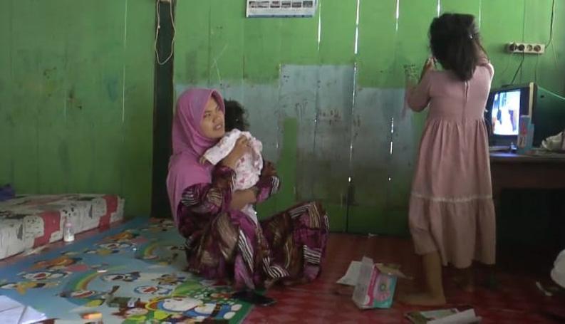 Balita di Grobogan Ini Derita Penyakit Langka, Kulit Tubuh Melepuh dan Mudah Terkelupas