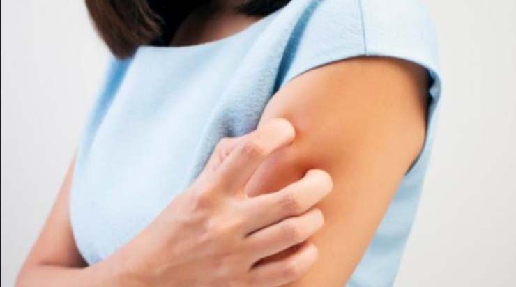 Ini Penyebab Penyakit Herpes, Gejala dan Cara Mengobati, Waspada Jika Area Genital Anda sering Luka 