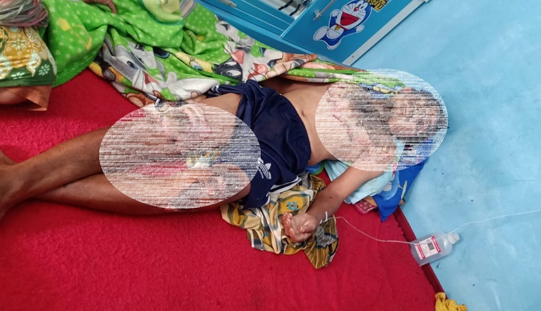 Pedagang di Sukabumi Masuk Wajan Berisi Minyak Panas Akan Dioperasi