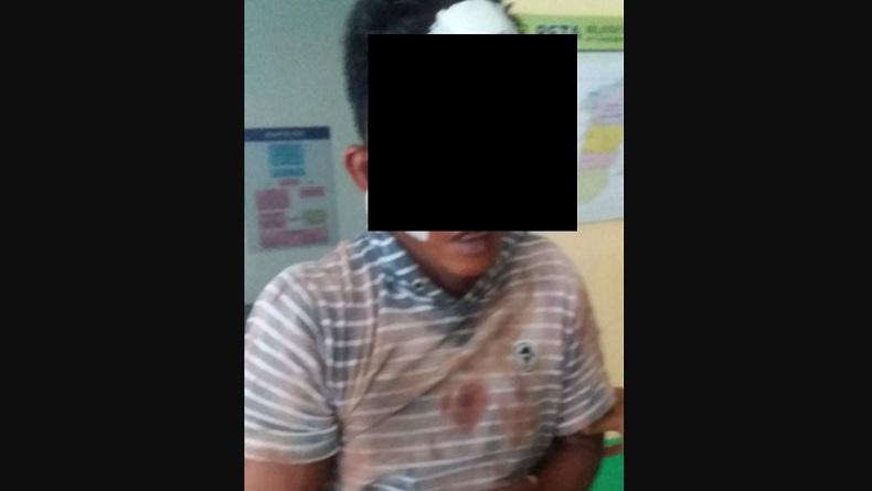 Gelapkan Sepeda Motor, Pemuda di Sergai Babak Belur Dihajar Warga