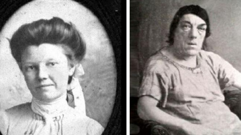 Kisah Mary Ann Bevan, Perawat yang Ikuti Kontes Wanita Terjelek di Dunia Bikin Haru
