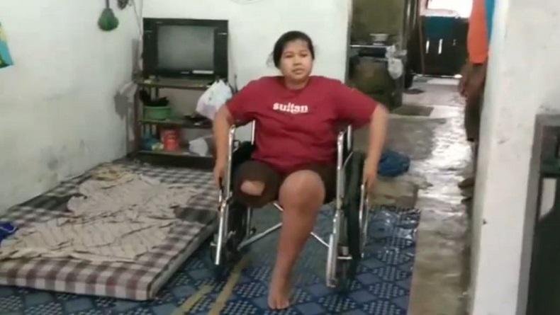 Miris, Perempuan Disabilitas di Brebes Ini Derita Tumor Ganas pada Lutut Kaki 