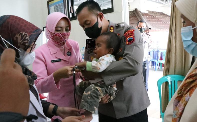  Momen Haru Kapolres Banjarnegara Gendong Anak Penderita Tumor Mata Sebesar Bola Tenis 