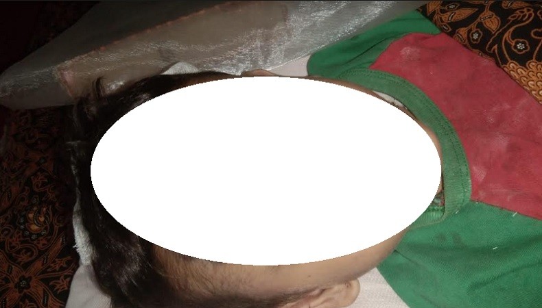 Padang Pariaman Gempar! Bocah 3 Tahun Tewas Diduga Dianiaya Ibu Tiri