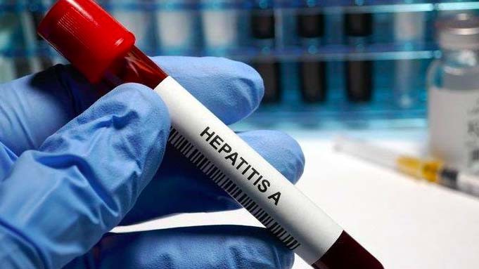 Waspada, WHO Nyatakan Hepatitis Akut pada Anak sebagai KLB