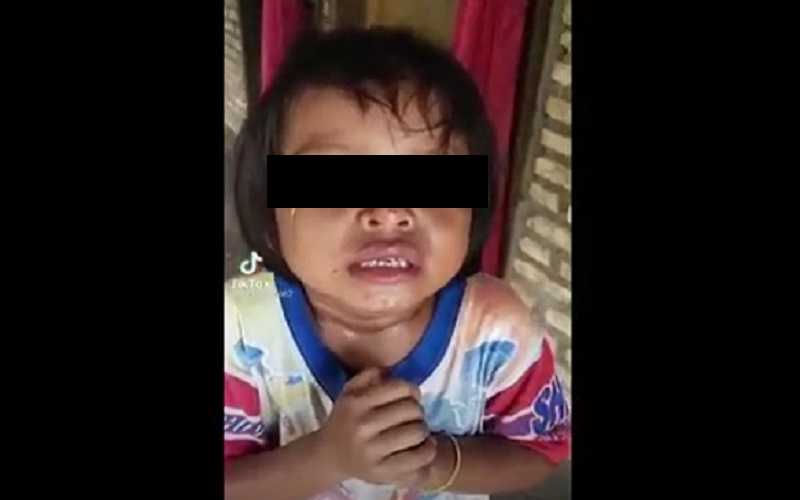 Viral Bocah Dianiaya di Serdangbedagai, Bibir Bengkak Nangis Ngaku Dipukul Pamannya