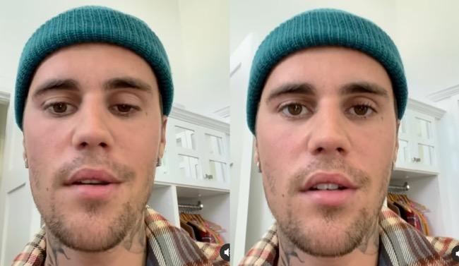 Batalkan Konser, Justin Bieber Umumkan Alami Kelumpuhan Wajah hingga Tak Bisa Senyum!