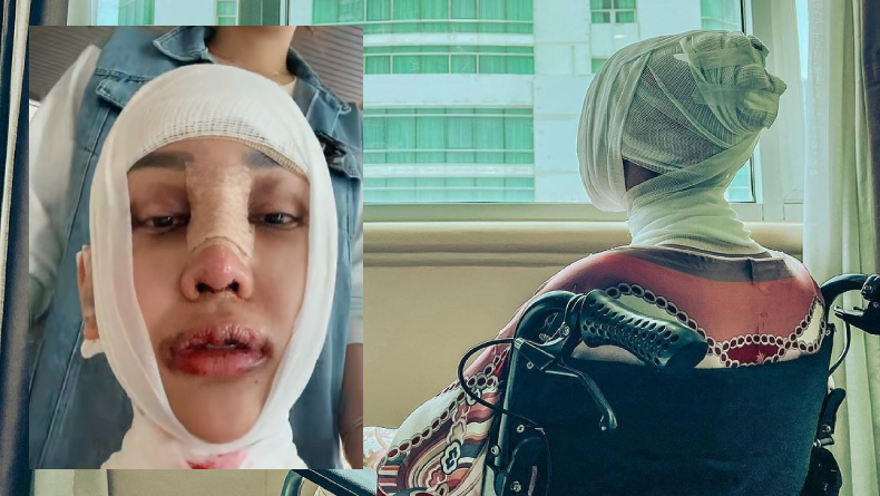 Kondisi Lucinta Luna Pasca Operasi Pemotongan di Bagian Leher, Mengaku Kesulitan Menelan Makanan 