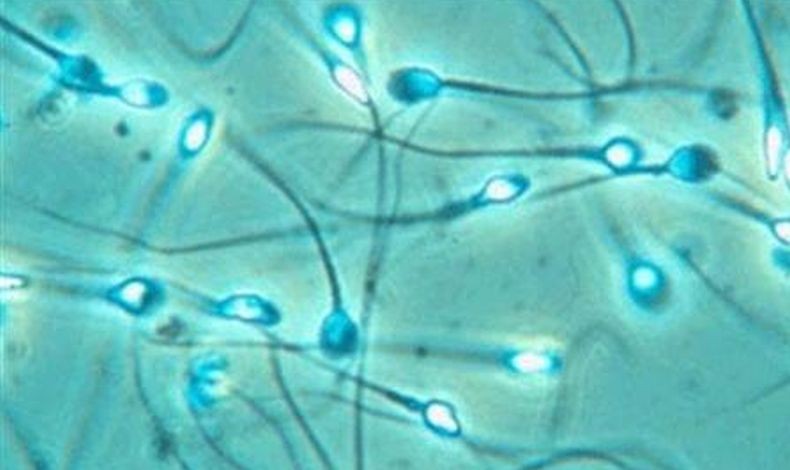 11 Cara Memperbaiki Kualitas Sperma agar Cepat Hamil, Hindari Kebiasaan Sepele Ini