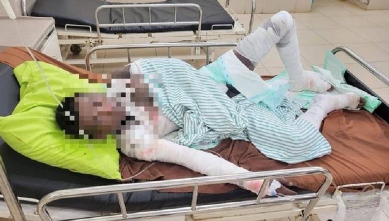 Pemuda di Lampung Timur Tewas Bakar Diri Gegara Dibully Anak Miskin