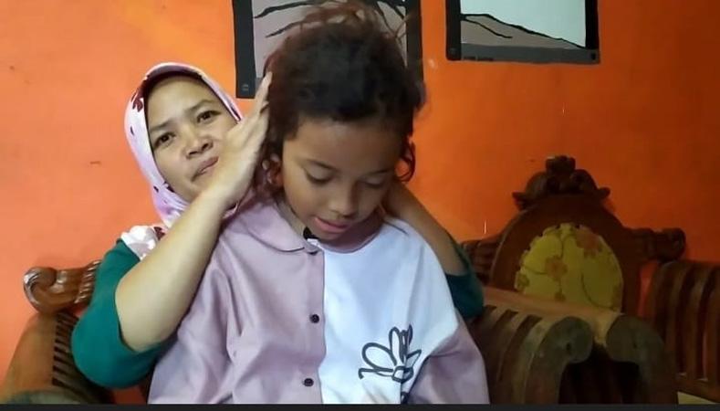 Fenomena Unik Bocah Dieng, Alami Demam hingga Mengigau sebelum Rambut jadi Gimbal