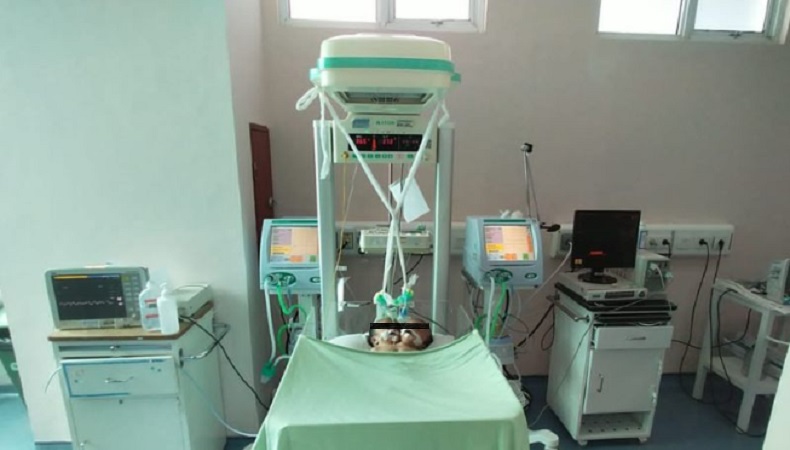 Baru 2 Hari Jalani Perawatan, Bayi Berkepala 2 Asal Padang Pariaman Meninggal Dunia