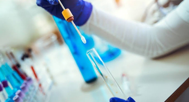 Mengenal Pentingnya Tes DNA untuk Cek Kesehatan hingga Risiko Penuaan Dini