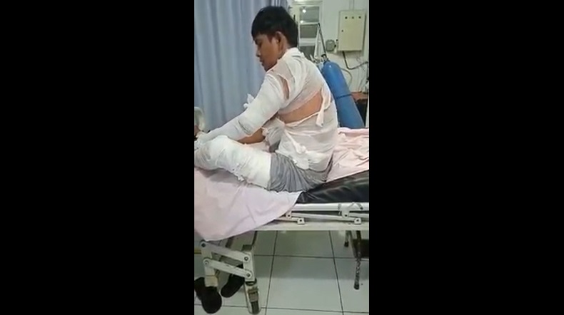 Gerobak Ditabrak Pemotor, Tubuh Penjual Mi Ayam di Jember Melepuh Tersiram Air Panas