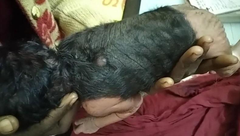 Duh, Bayi Ini Lahir dengan Kulit Hitam Berbulu di 60 Persen Tubuhnya