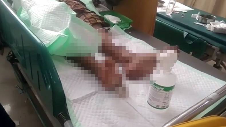 Situbondo Geger, Pegawai Pukesmas Bersimbah Darah Coba Bunuh Diri Pakai Alat Cukur