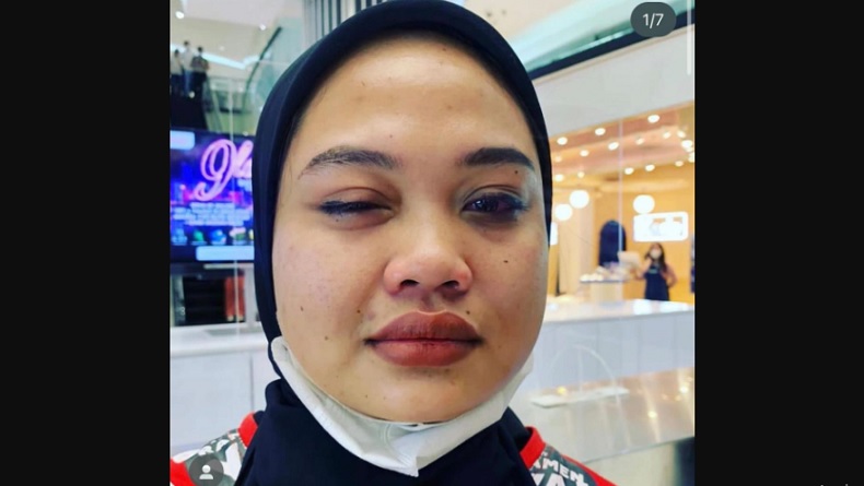 Viral Driver Ojol Pukul Karyawan Restoran di Jakbar, gegara Salah Ambil Orderan