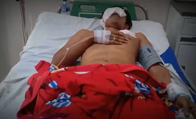 Petani Karet di Muaro Jambi Diserang Beruang, Wajahnya Dicakar Kini Terancam Buta
