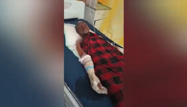 Tabung Elpiji Meledak di Banyuwangi, 4 Orang Sekeluarga Luka Bakar Serius 