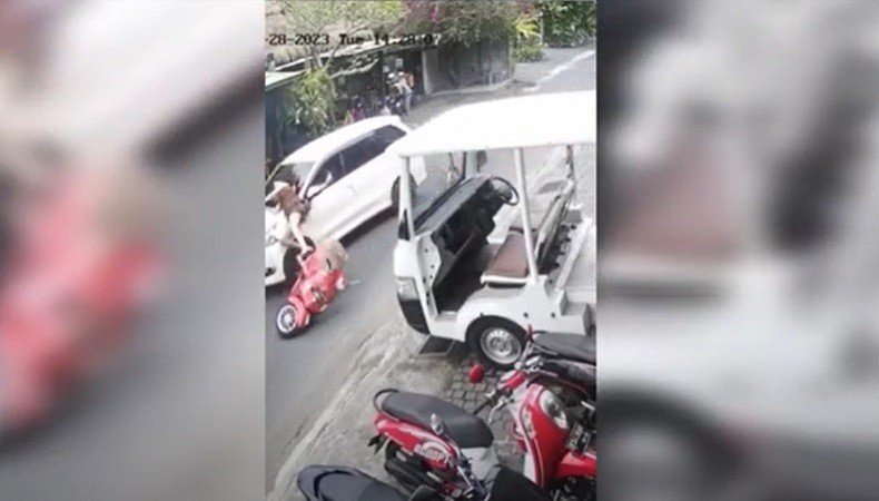 Selebgram Kecelakaan di Ubud Bali, Tangan dan Betis Patah usai Tertabrak Mobil
