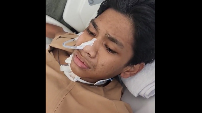 Kondisi David Korban Penganiayaan Mario Dandy Membaik, Pendengaran Sudah Merespons