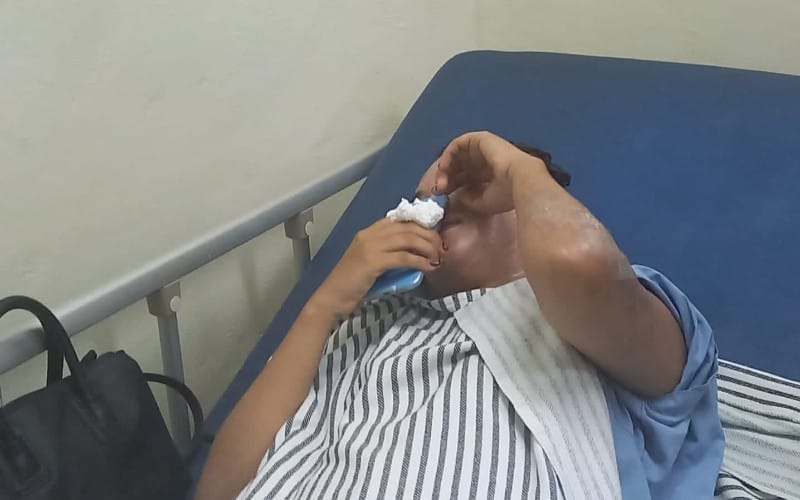 Perempuan Cantik Pedagang Thai Tea Luka Bakar Disiram Cuka Parah oleh OTD