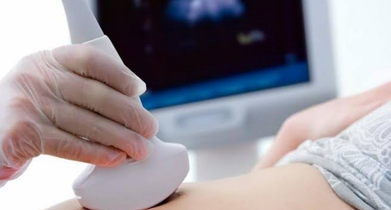 Tips bagi Pasutri agar Promil Berhasil, Perhatikan Makanan hingga Konsultasi Kesuburan 