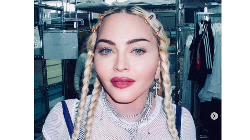 Madonna Batal Konser Gara-Gara Infeksi Bakteri, Kini Terbaring di ICU