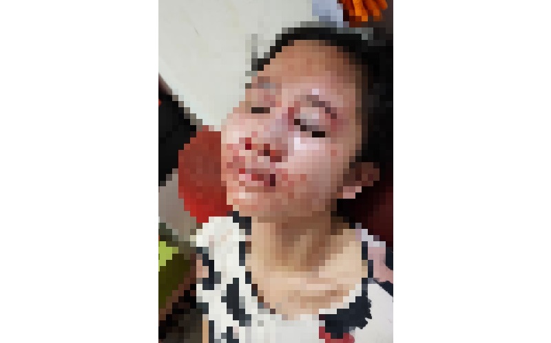 Suami Pelaku KDRT di Serpong Kirim Pesan Ancaman ke Keluarga Istri: Gue Bantai Satu-Satu