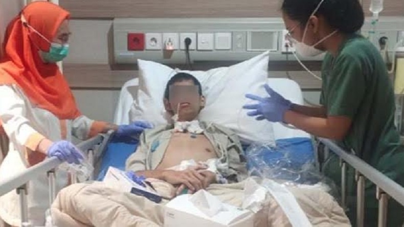 Unbraw Siap Bantu Advokasi Mahasiswanya Luka Parah Terjerat Kabel Fiber Optik