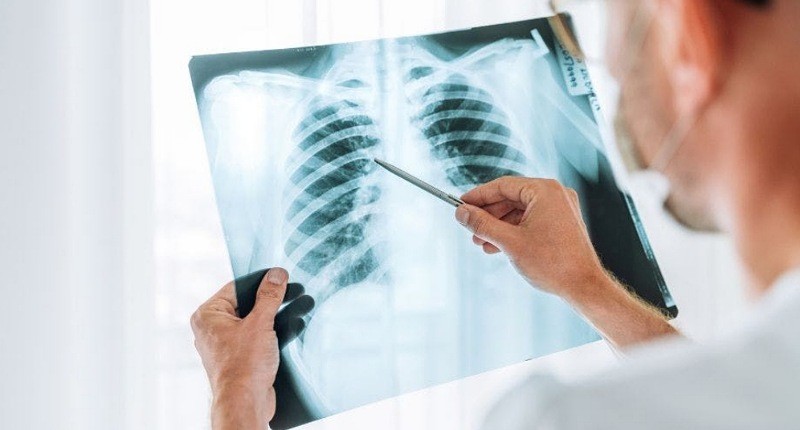 Marak Kasus Pneumonia Misterius, Senator Usul Warga AS Dilarang ke China