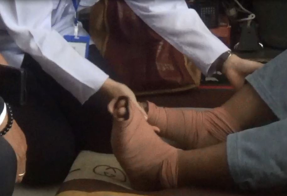 Siswa SMP di Madiun Dihukum Guru Lari Keliling Lapangan hingga Kaki Melepuh