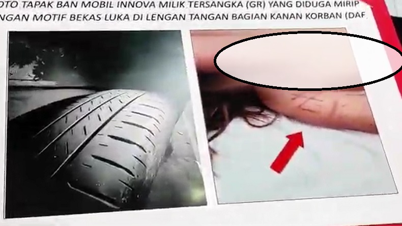 Kasus Anak Anggota DPR Aniaya Kekasih hingga Tewas, Ada Luka Motif Ban Mobil di Lengan Korban