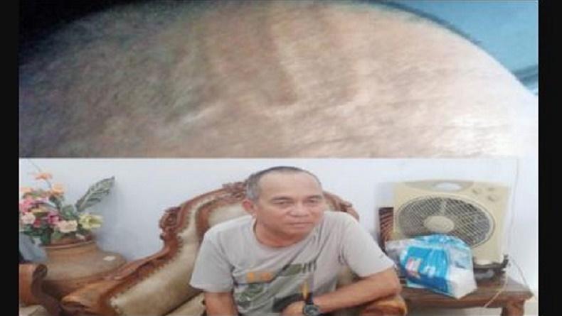 Heboh Lafaz Allah Muncul di Kening Pria di Gowa