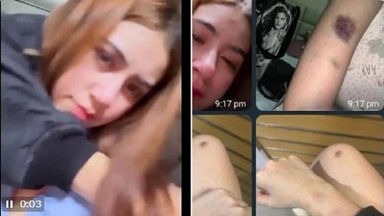 Polisi Selidiki Dugaan Penganiayaan Rinoa Aurora yang Viral, Laporan sejak 8 November