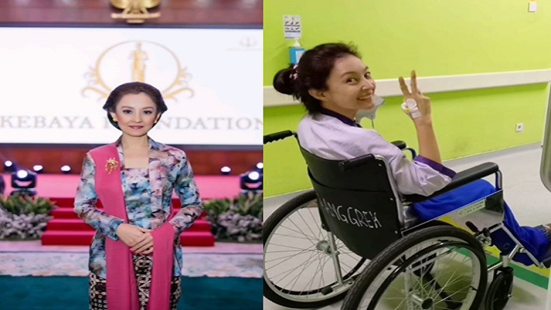 Cerita Artis Cantik Kena Tumor di Usia 40-an, Putri Patricia: Mohon Doanya 