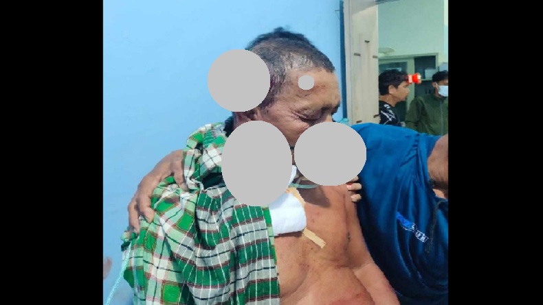 Kronologi Kades di Kolaka Dibacok Warga saat Tidur hingga Hidung Robek, Pelaku Bawa Parang