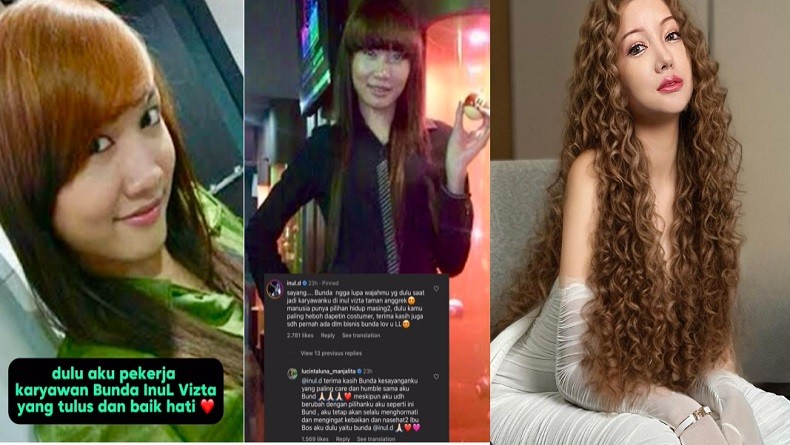 Menolak Tua, Lucinta Luna Habiskan Rp11 Miliar Operasi Mata, Jidat dan Hidung 