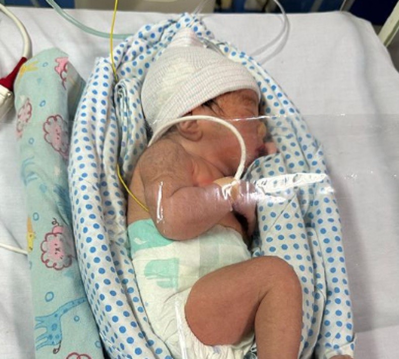 Selamat! Komika Marshel Widianto Dikaruniai Anak Kedua