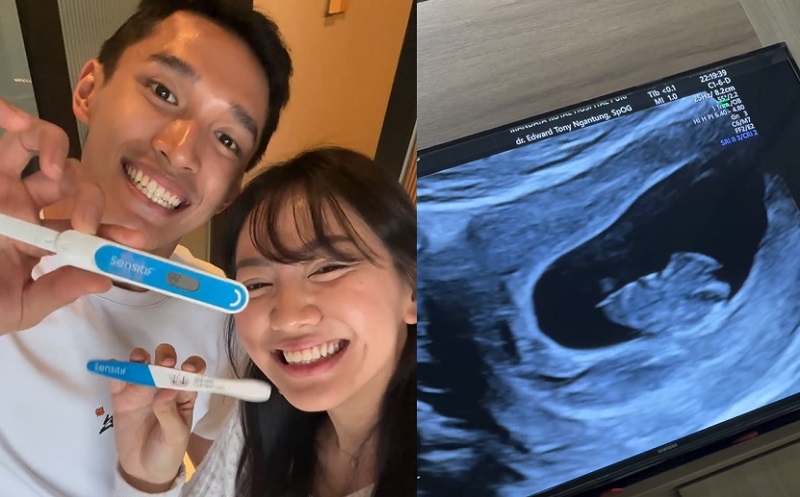 Full Senyum! Istri Jonatan Christie Umumkan Kehamilan Anak Pertama