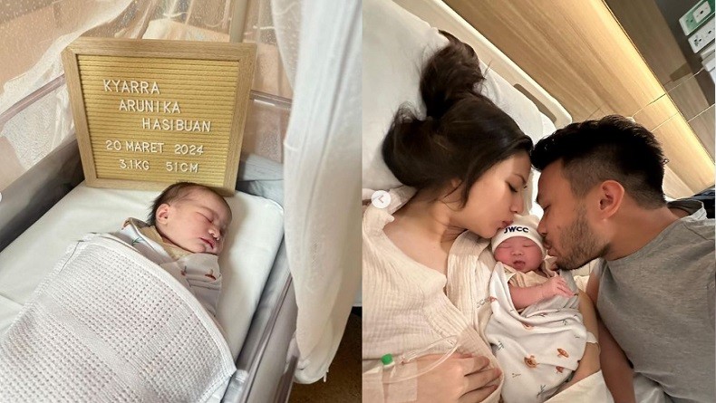 Otto Hasibuan Cerita Detik-Detik Persalinan Jessica Mila: Dia Nangis Pengen Normal