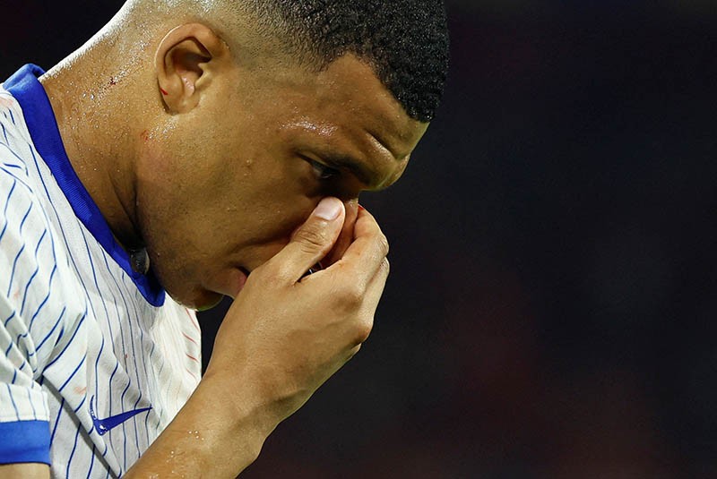 Mbappe Dipaksakan Main di Euro 2024 meski Hidung Patah, Rencana Operasi Sampai Ditunda