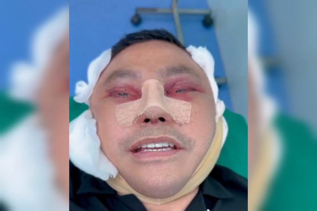 Kejagung Tangkap Anggota DPR Fraksi Nasdem Ujang Iskandar di Bandara Soetta